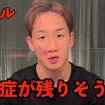 「後頭部を殴られ危険な状態です」…SATORUの頭を金属で殴った犯人が〇〇だと判明し炎上！